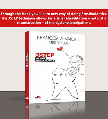 3Step additive prosthodontics